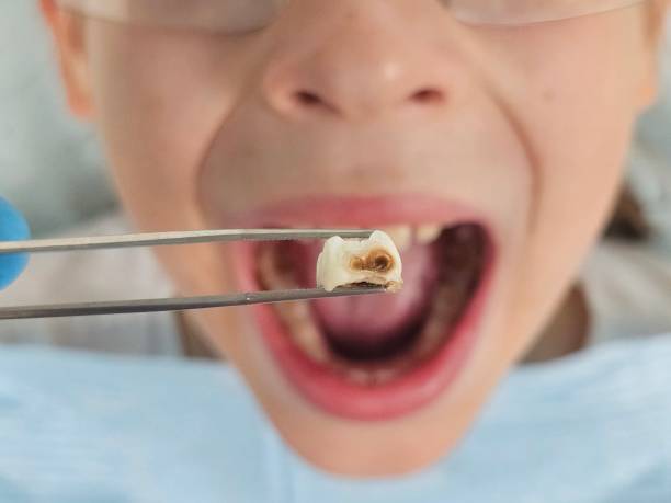 Best Emergency Cosmetic Dentistry in Mcconnelsville, OH